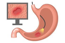 Top Endoscopy specialist In Hyderabad