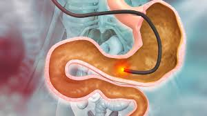 Top Gastroenterologist In Hyderabad