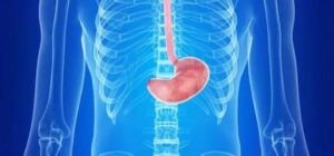 Oesophageal Cancer