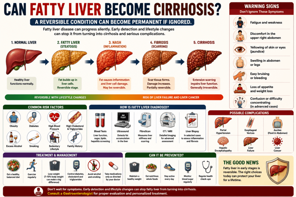 the progression of fatty liver disease to cirrhosis. The image shows a healthy liver, fatty liver, liver inflammation (steatohepatitis), fibrosis, and cirrhosis, along with common risk factors, warning signs, diagnostic tests such as FibroScan and liver function tests, and healthy lifestyle habits to help prevent permanent liver damage.