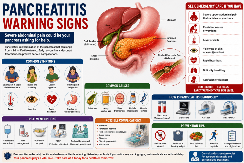 pancreas with surrounding digestive organs, illustrating the warning signs of pancreatitis. The infographic highlights severe upper abdominal pain, pain radiating to the back, nausea, vomiting, fever, jaundice, common causes such as gallstones and alcohol use, diagnostic tests, treatment options, and emergency warning signs.