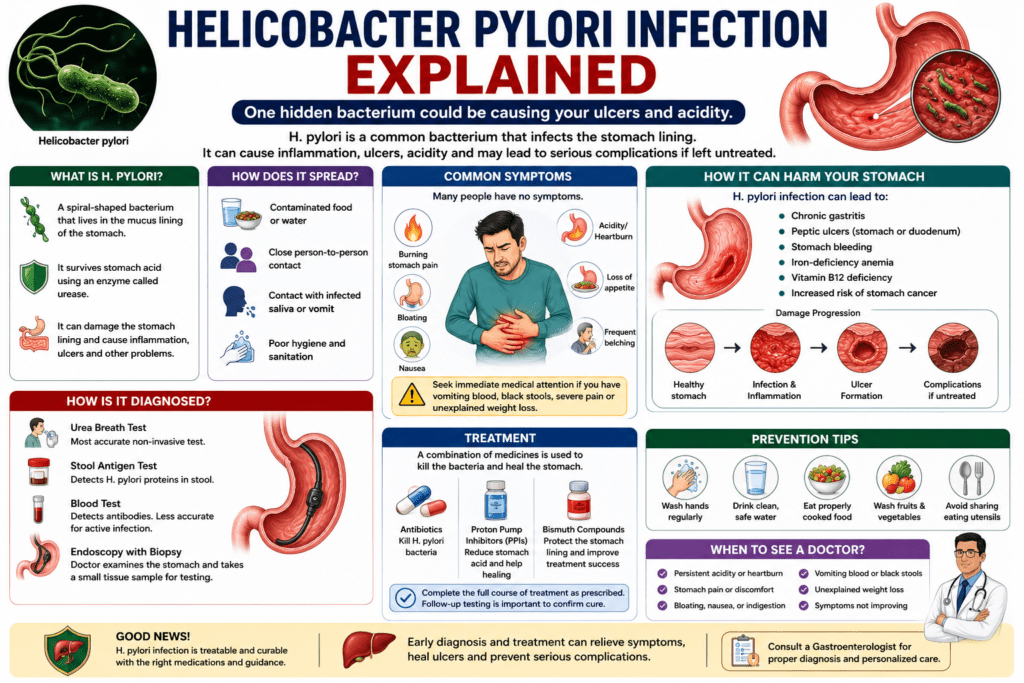 A comprehensive medical infographic explaining Helicobacter pylori (H. pylori) infection. The infographic illustrates how the bacterium infects the stomach lining, its common symptoms, causes, diagnostic tests, treatment options, possible complications such as ulcers and gastritis, prevention tips, and when to consult a gastroenterologist.