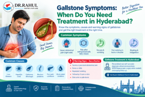 Gallstone Symptoms: When Do You Need Treatment in Hyderabad?